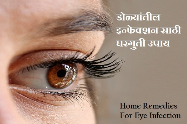 Home Remedies For Eye Infection