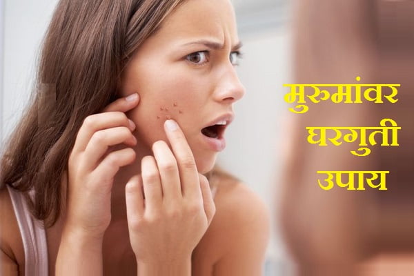 Pimples