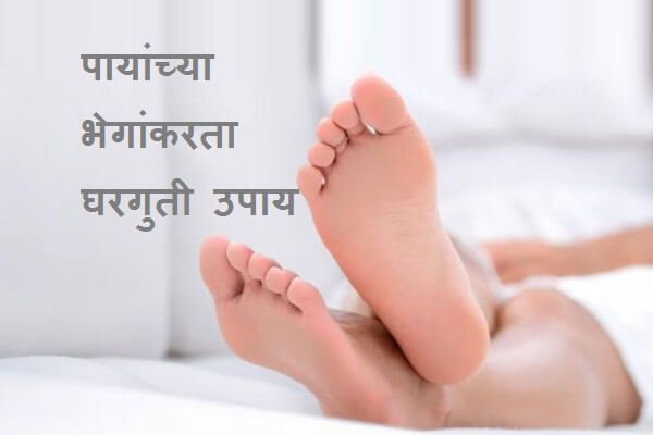 Home Remedies For Cracked Heels